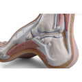 Hohlfuß (Pes cavus) – 3B Smart Anatomy