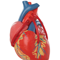 Klassik-Herz mit Bypass, 2-teilig – 3B Smart Anatomy
