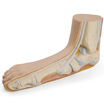 Plattfuß (Pes planus) – 3B Smart Anatomy