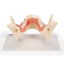 Zahnerkrankung, 2-fache Größe, 21-teilig – 3B Smart Anatomy 